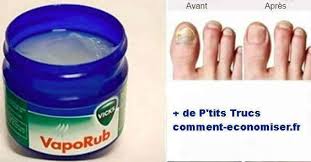 Epingle Sur Astuces