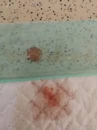 Blood and mucus in dog stools lovetoknow. Some Of My 6 Week Old Puppies Are Pooping Little Mucus Bits Of Blood After Their Solid Poop Please Help Petcoach
