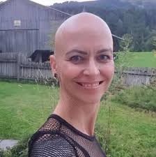 Bald woman by choice added a new photo.