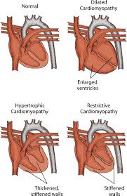 Heart rate refers to the number of time your heart beats in a given period of time, usually in one minute. Acquired Heart And Blood Vessel Disorders In Cats Cat Owners Merck Veterinary Manual