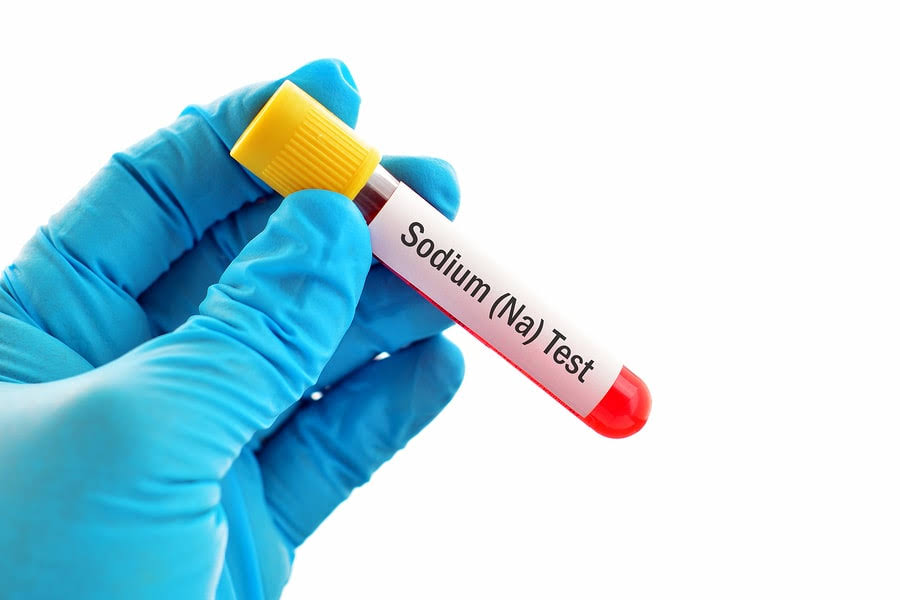 SODIUM ( NA+) product image