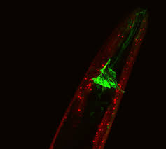 Unlock the secrets of complex neural circuits. Researchers Peer Inside The Mind Of The Worm For Clues On How Memories Form