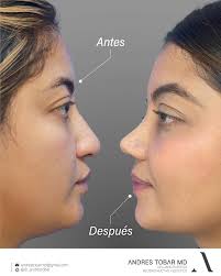 Andres Tobar Padilla MD (@dr_andrestobar) • Threads, Say more