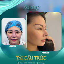 THẨM MỸ VIỆN AONE