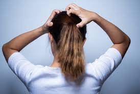 But if you have scalp psoriasis. 7dut7vznjky7um
