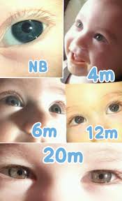 Btdt Eye Color Progression Pics Babycenter