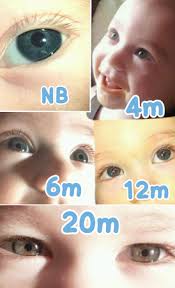 btdt eye color progression pics babycenter