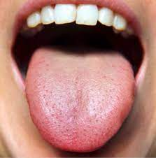 You Can T Ignore These Things Your Tongue Is Warning You About Healthy Tongue Tongue Health Health
