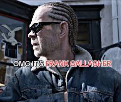 Frank Gets Braids Shameless