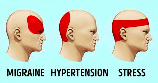 How To Get Rid Of A Headache In 5 Minutes Without Pills Getting Rid Of Headaches Pressure Points For Headaches How To Relieve Headaches