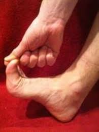 Symptoms and signs include pain, swelling, a popping sound, and limited range of motion. Turf Toe Orthoinfo Aaos