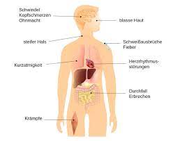 Niedriger Blutdruck Hypotonie Symptome Ursachen Behandlung