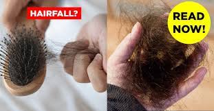 Bacteria and fungal infection from poor hygiene can cause hair loss. How To Stop Hair Fall 20 Tips Natural Methods Treatments