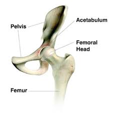 Anterior Approach To Hip Replacement Surgery Fort Healthcare Hip Replacement Hip Replacement Surgery Hip Implants