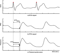This reading is always the the first or top number. Continuous Blood Pressure Monitoring As A Basis For Ambient Assisted Living Aal Review Of Methodologies And Devices Springerlink