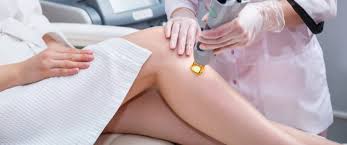 أضرار إزالة الشعر بالليزر معلومات هامة ويب طب