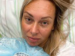 Julia holz quería obtener una segunda opinión sobre su cáncer en la organización benéfica de berlín. Influencerin Julia Holz Nach Lymphknoten Op Sie Gibt Ein Gesundheitsupdate Bunte De