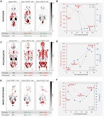 Frontiers | Quantitative imaging for 177Lu-PSMA treatment response  monitoring and dosimetry