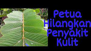 Siap kau tom, aku dapat kau nanti, memang ada yang kena pukul! Petua Hilangkan Kurap Panau Dan Kudis Buta Sirap Ais Youtube