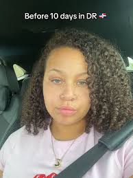 Black Person Sun Tan Before and After