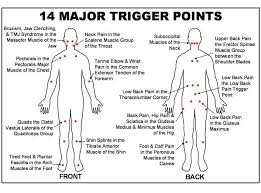 Trigger Point Chart Free Download Google Search Medical