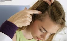Scalp tenderness is a common symptom. Preventing Scalp Sunburn Yourbeautycraze Com