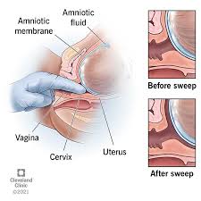 نتیجه جستجوی لغت [induce] در گوگل