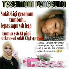 Contextual translation of sakit gigi into english. Gigi Rosak Means In English
