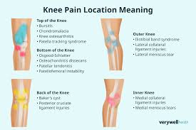Image result for gout symptoms knee