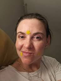 LitBear Large Pimple Patches 50% off w/ code **6K83UKNI **(works