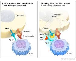 It is more common among men than women and advancing age puts you at higher risk of developing bladder cancer. Bladder Cancer Treatment Pdq Patient Version National Cancer Institute