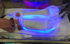Image result for Phototherapy