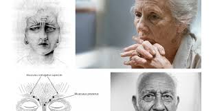 Praksisnytt Stavanger universitetssjukehus: Deprimerte pasienter > 64 år  søkes til Botox studie