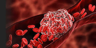 Astrazeneca, who did not immediately respond to a request for comment, has previously said it has found no link between its vaccine and a higher risk of blood clots, something borne out by an. Y1eshj2dw94acm
