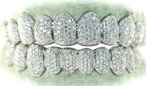 Polished diamond cut white gold teeth. White Gold Grillz White Gold Grillz Johnny Dang Jewelry Gold Grillz