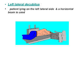 It is performed by having a patient lie on their left side, left hip and lower extremity straight, and right hip and knee bent. Lecture 3 Erect Positions Surface Of Body Closest
