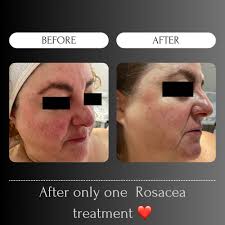 THE BEST 10 HAIR REMOVAL near MONTRÉAL-NORD, MONTREAL, QC, CANADA