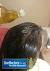 Head Lice Treatment Home Remedy