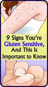 10 Signs You Re Gluten Sensitive And This Is Important To Know In 2020 Gluten Sensitivity Feel Tired Daily Health Tips