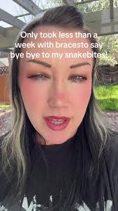 Changing Snake Bite Jewelry After A Week