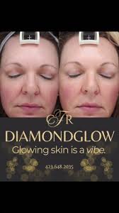 Center for Facial Rejuvenation