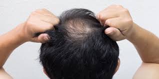 Another topical use of gelatin is as a very firm gel for hair. What Is The Relation Between Collagen And Hair Loss