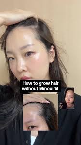 Effective Hair Growth with Seapuri Minoxidil