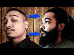Here are some minoxidil beard before and after results! Grow A Thicker Fuller Beard With Minoxidil Burly Beard Boys Minoxidil Beard Minoxidil Beard Before And After