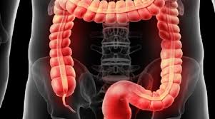The tubular organ works around the clock to remove waste products from your body. What Is The Stenosis Of The Colon That Forced Pope Francis To Perform An Operation In The Jamili Clinic Digichat
