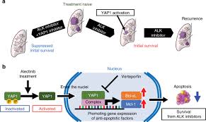 Once a year if it's more than 5 years since remission. Yap1 Mediates Survival Of Alk Rearranged Lung Cancer Cells Treated With Alectinib Via Pro Apoptotic Protein Regulation Nature Communications
