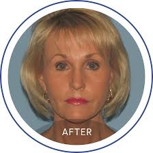 Plastic Surgery & Med Spa in Mentor, OH