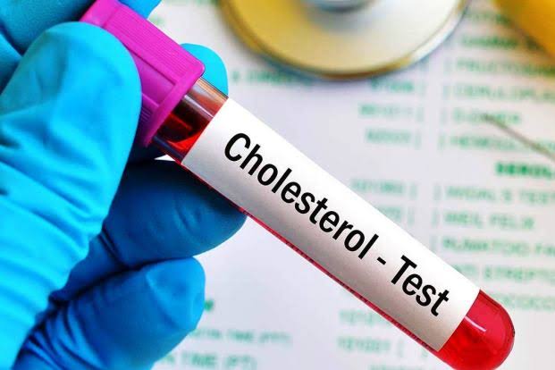 CHOLESTEROL product image