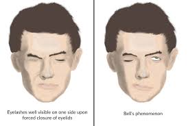 Request an appointment at mayo clinic Facial Nerve Palsy Knowledge Amboss