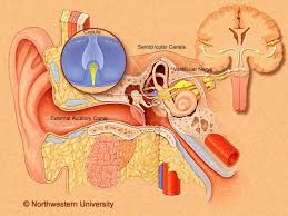 Image result for Bacterial Labyrinthitis